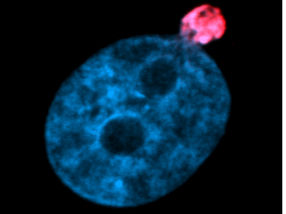 Actin Scaffold in Cell Nucleus Explains Survival of Cancer Cells