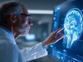 Setting the Course for AI-Assisted Radiology