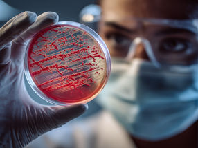 Experimental mRNA therapy shows potential to combat antibiotic-resistant infections